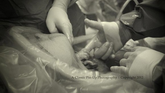 Потрясающее фото... Маленький человек, Nevaeh Atkins, схватила доктора за палец во время проведения кесарев