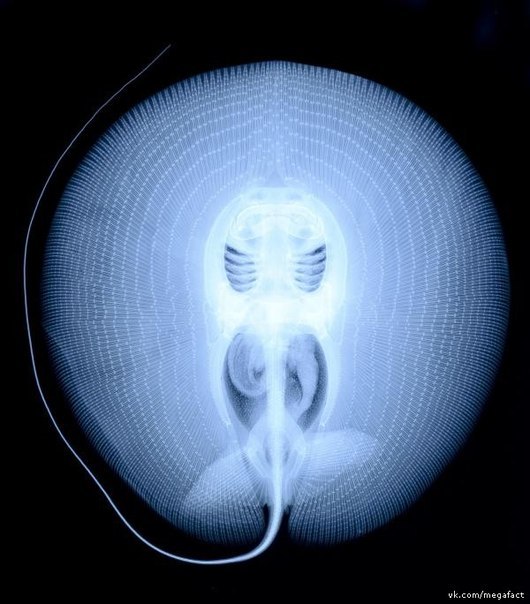Рентгеновский снимок ската.