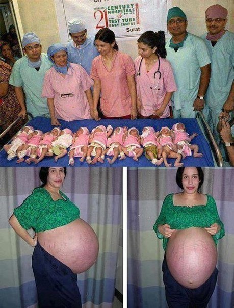 Индийская женщина родила 11 детей.