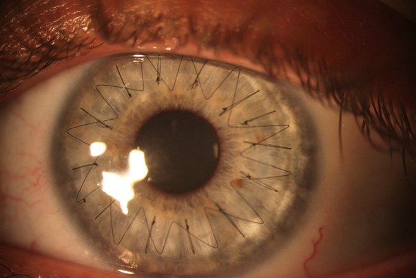 На этой невероятной макро-фотографии человеческого глаза 